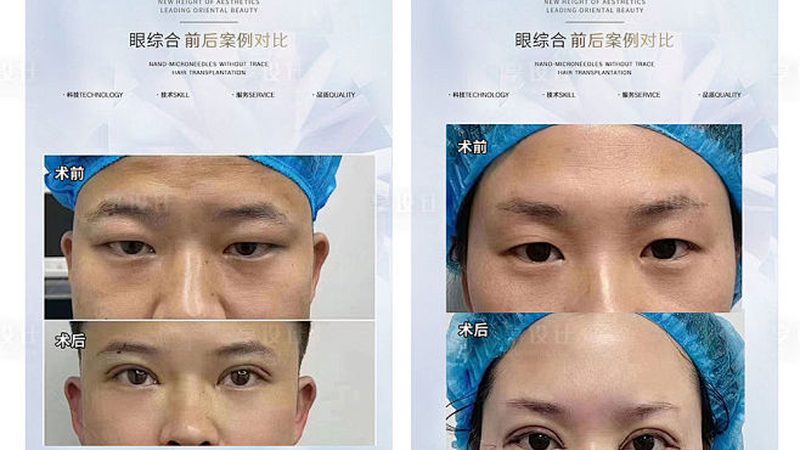 小标题：选择隆鼻医院，关注这些关键点