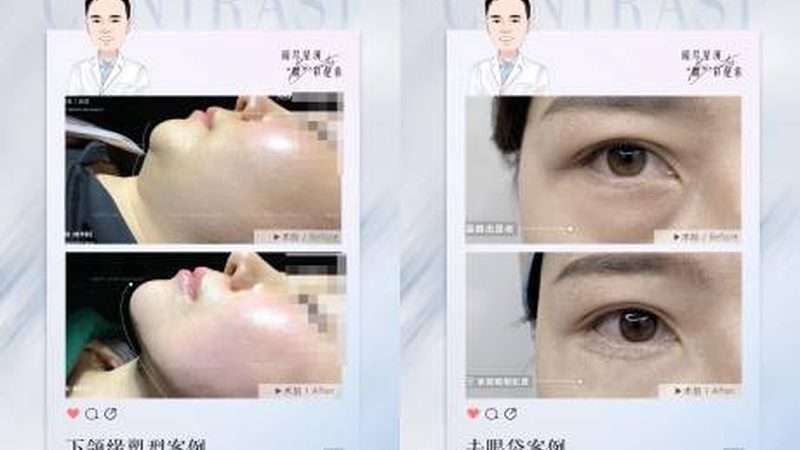 激光美容术前不能吃什么