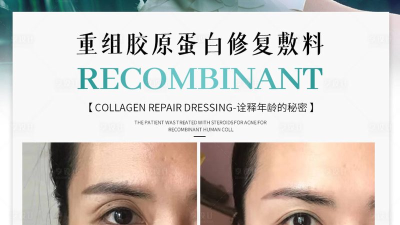 膨体隆鼻与硅胶隆鼻：排异率低的选择揭秘