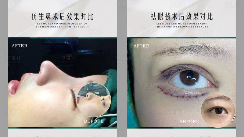 虽然热玛吉是非手术技术，但仍存在一定的副作用。常见的副作用包括：