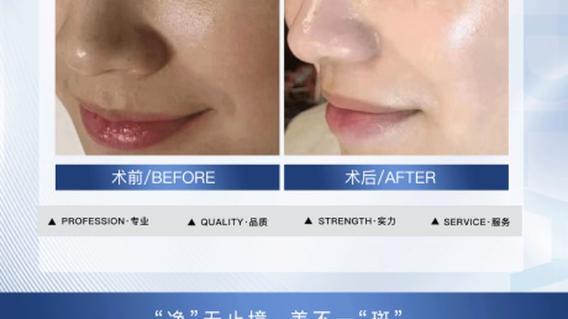 瘦脸面膜和按摩操哪个去浮肿快