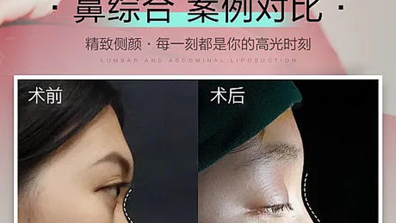 注射美容的收费标准通常由以下几个部分构成：