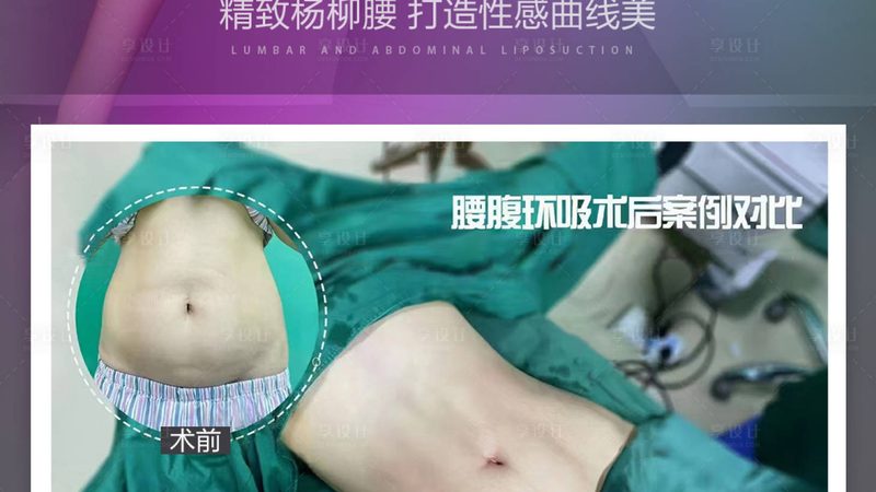 玻尿酸精华液加盟品牌规格标准