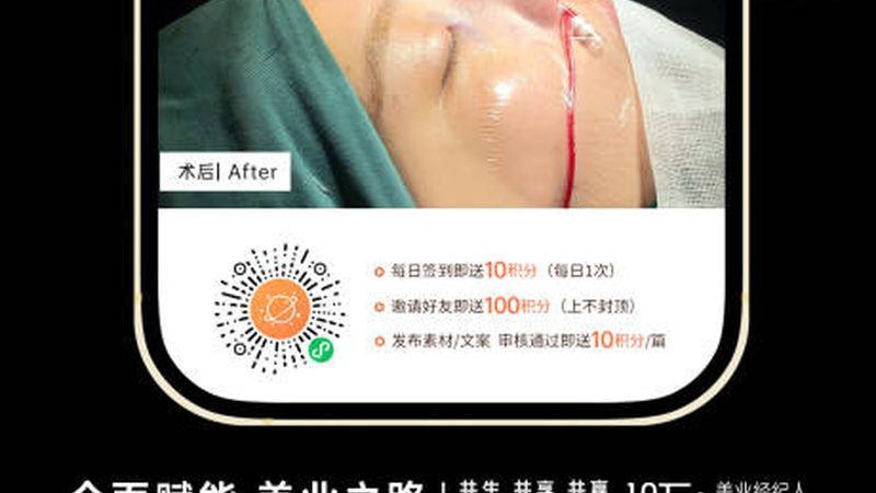 光子嫩肤医疗美容仪器哪家好