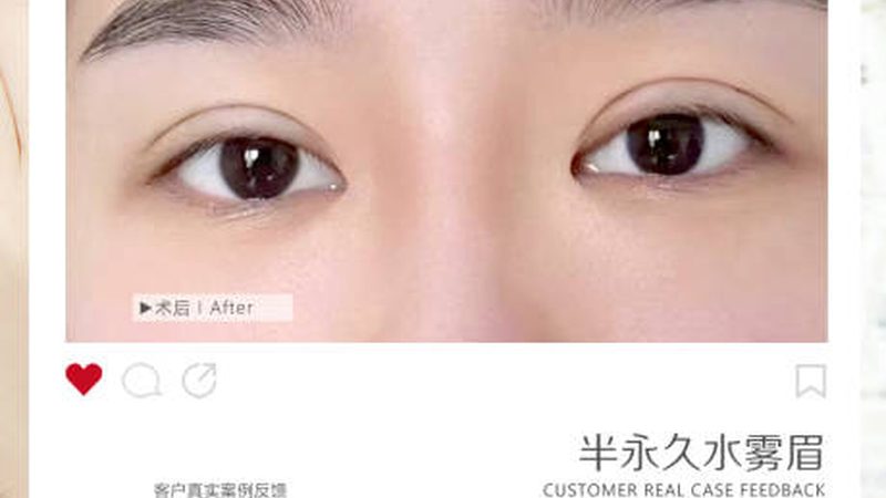 揭秘注射美容品牌正规资质的识别方法