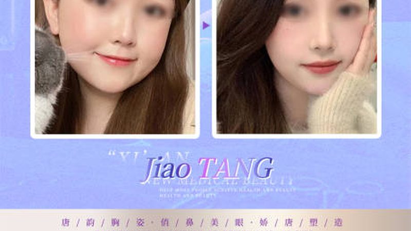 肉毒素注射后，这些注意事项你了解吗？**