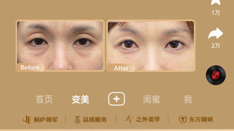 皮肤管理中心产品加盟，先看清这五道门槛