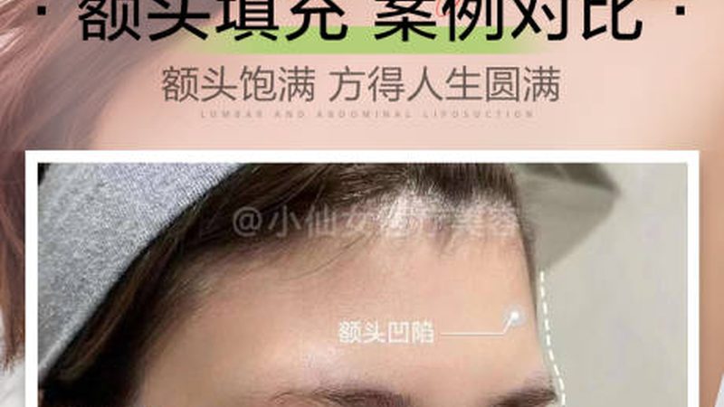 注射美容，你了解多少？**